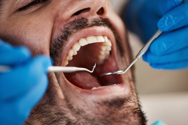 Best Emergency Dentist for Knocked-Out Tooth in Visalia, CA